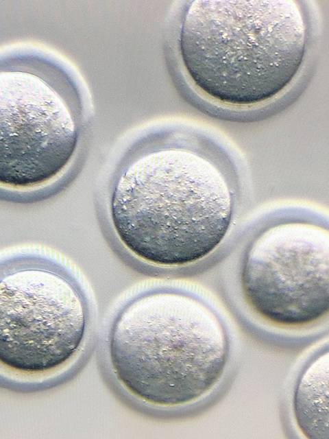 La imagen muestra una serie de esferas brillantes y plateadas bajo un microscopio.