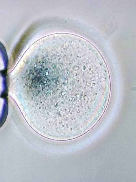 La imagen muestra una vista microscópica de un óvulo en un entorno de laboratorio.