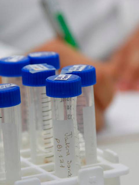 La imagen muestra tubos de ensayo en un soporte, con una mano anotando en un cuaderno al fondo.