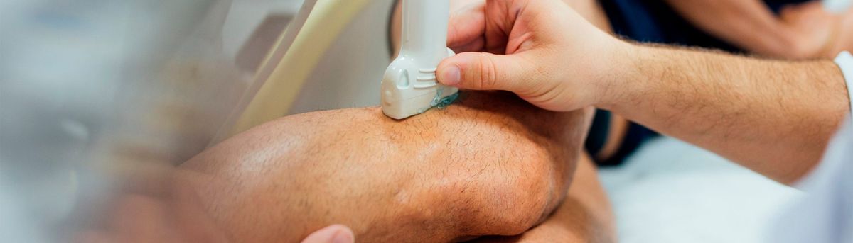 Un procedimiento médico donde se aplica un ultrasonido en una rodilla.