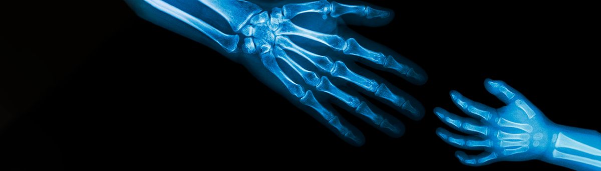 La imagen muestra una radiografía de un brazo y una mano, destacando los huesos de ambos.