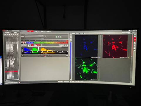 Pantalla mostrando análisis de imágenes con diferentes canales de fluorescencia.