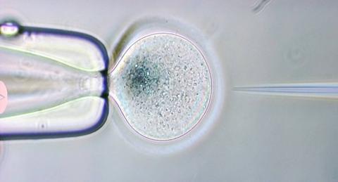 La imagen muestra la manipulación de una célula en un entorno de laboratorio utilizando un microscopio.