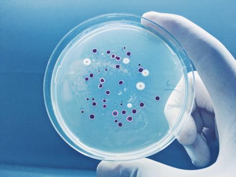 Una mano sostiene un plato de Petri con cultivos bacterianos visibles en el interior.