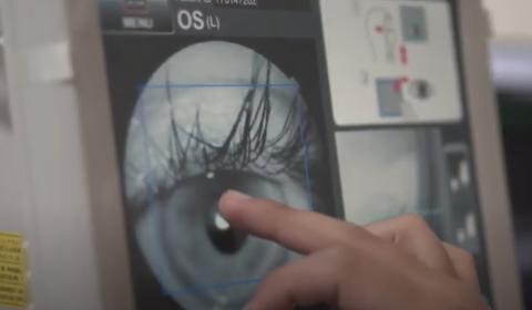 Una imagen que muestra un ojo humano siendo examinado en un dispositivo médico.