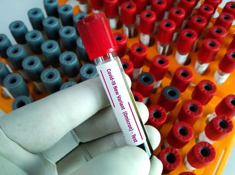 Un tubo de ensayo etiquetado para una prueba de COVID-19 variante Ómicron entre otros tubos en un laboratorio.