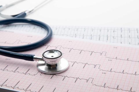 Un estetoscopio sobre una tira de electrocardiograma.