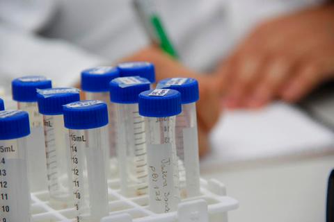 La imagen muestra tubos de ensayo organizados en un soporte, mientras en el fondo se observa una mano tomando notas.