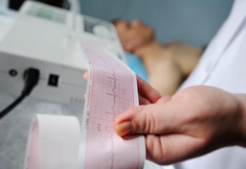 Una persona sostiene un gráfico de electrocardiograma mientras otra persona está acostada en una cama.
