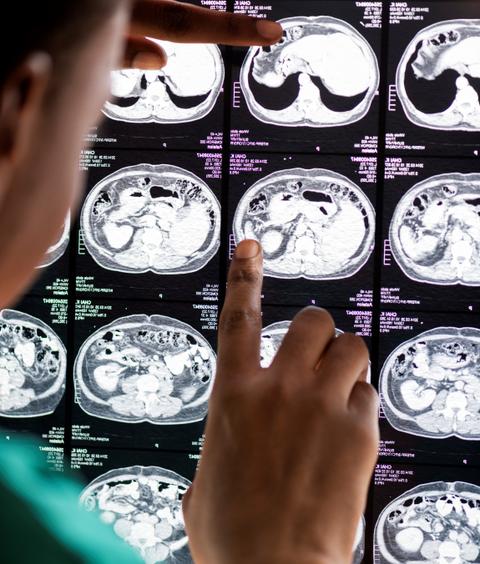 Una persona está examinando radiografías en un panel luminoso.