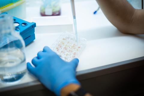 En la imagen se observa a una persona usando guantes azules mientras pipetea en una placa de cultivo celular.