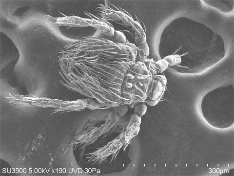La imagen muestra un ácaro visto a través de un microscopio electrónico.