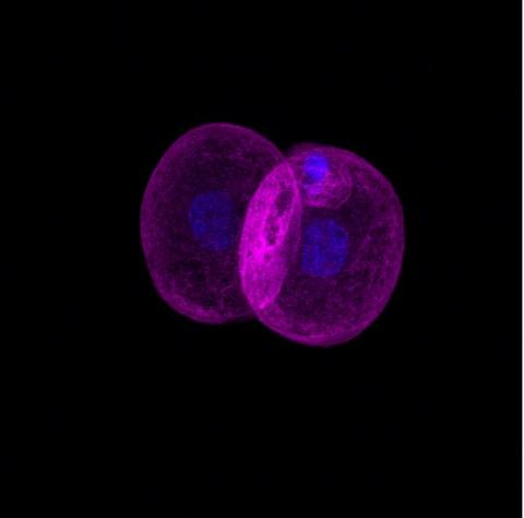 La imagen muestra dos células en proceso de división, destacadas en colores rosa y azul sobre un fondo negro.